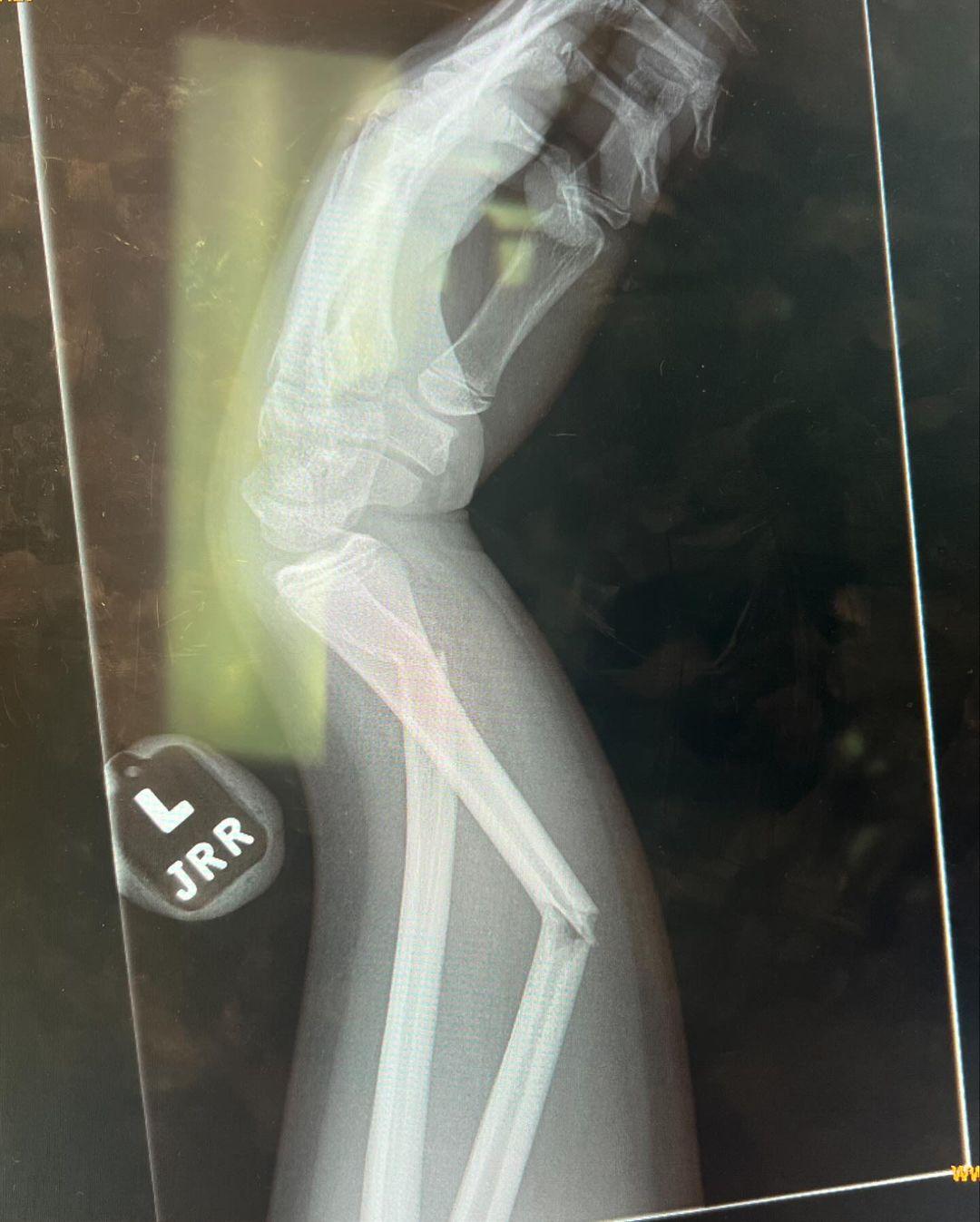 Kourtney Kardashian’s fans are asking questions about mysterious X-ray photo